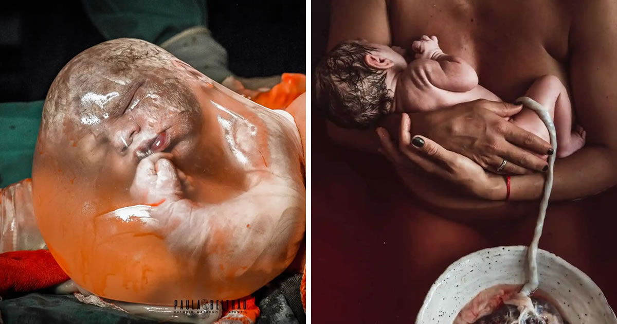 25 Heart-Touching Photos Of The Birth Photography Image Competition 2023